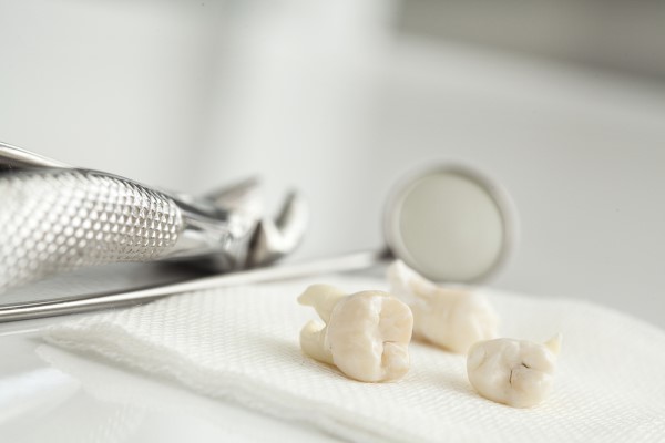 Is A Wisdom Tooth Extraction A Common Procedure?